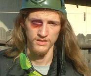Paintballda Yaralanma
